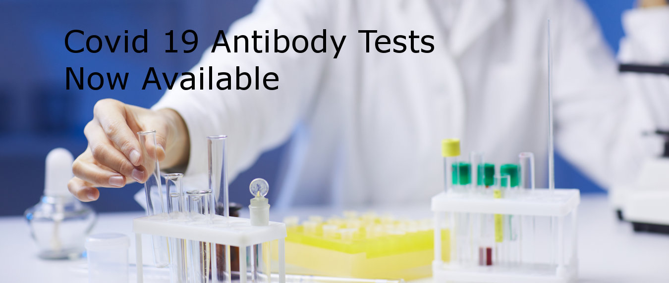 COVID-19 Rapid Antibody Test