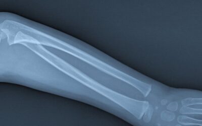 Understanding Worksite Joint Injuries and Recovery 