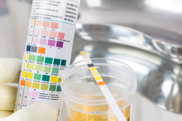 Routine test, urine rapid test, urine test strip, urine sample at Midtown Occupational Health Services.